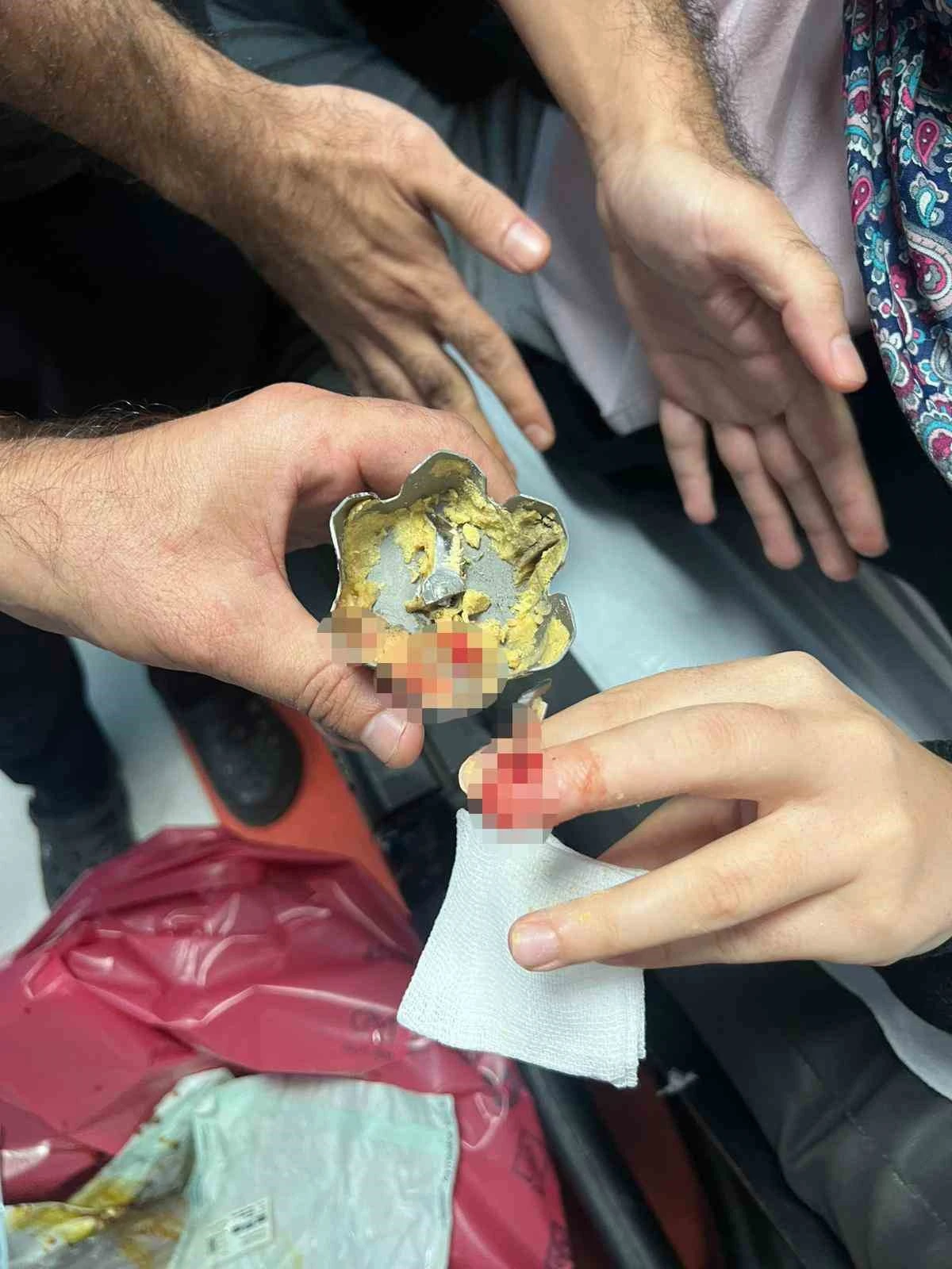 BATMAN'DA KORKUTAN KAZA: PARMAĞINA BLENDER PARÇASI BATAN EV HANIMINI İTFAİYE KURTARDI