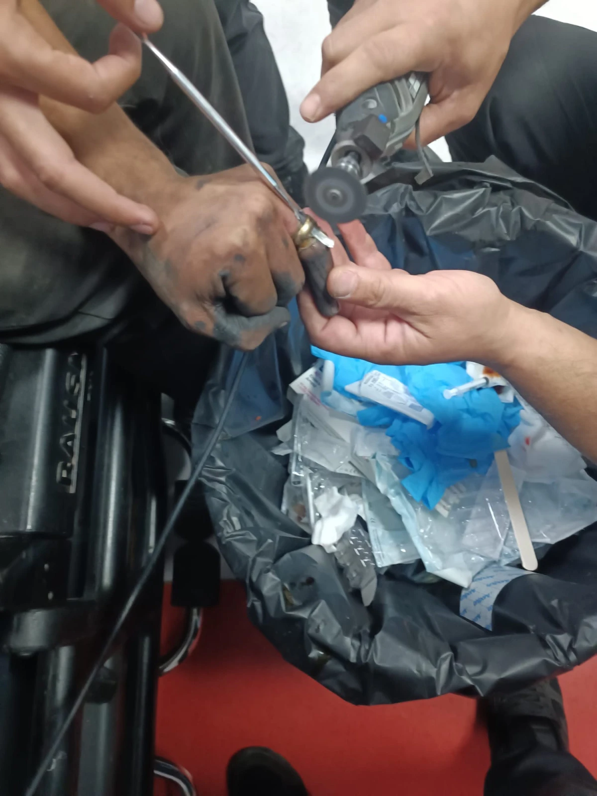BATMAN'DA PARMAĞINA SIKIŞAN YÜZÜK, HASTANEDE ÇIKARTILDI